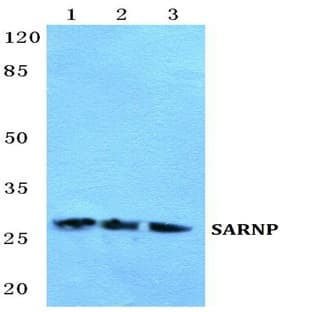 SARNP pAb avatar