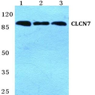 CLCN7 pAb avatar