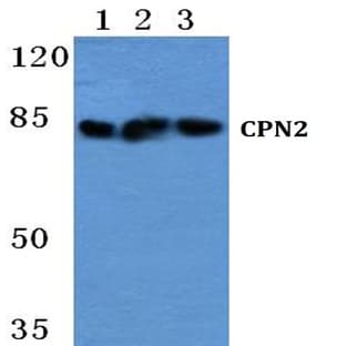 CPN2 pAb avatar