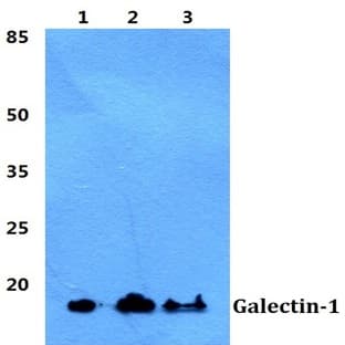 Galectin-1 pAb avatar