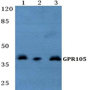 GPR105 pAb avatar
