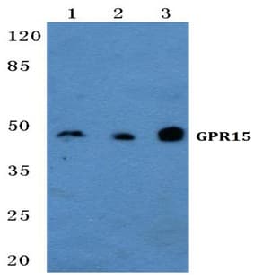 GPR15 pAb avatar