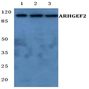 ARHGEF2 pAb avatar