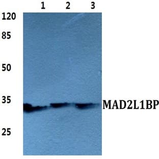 MAD2L1BP pAb avatar