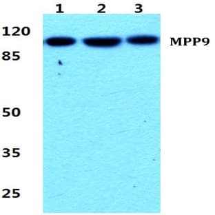 MPP9 pAb avatar