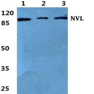 NVL pAb