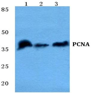 PCNA pAb avatar