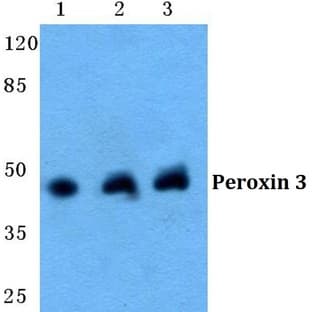 Peroxin 3 pAb avatar