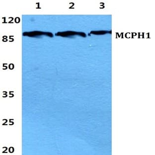 Microcephalin pAb avatar