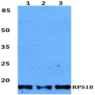 RPS18 pAb avatar