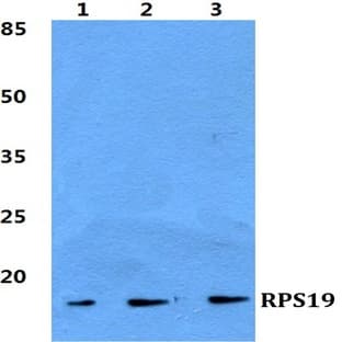 RPS19 pAb avatar