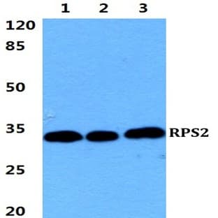 RPS2 pAb avatar