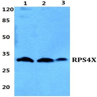 RPS4X pAb avatar