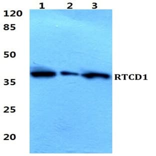 RTCD1 pAb avatar
