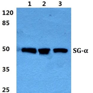 Sarcoglycan-(alpha) pAb avatar
