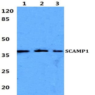 SCAMP1 pAb avatar