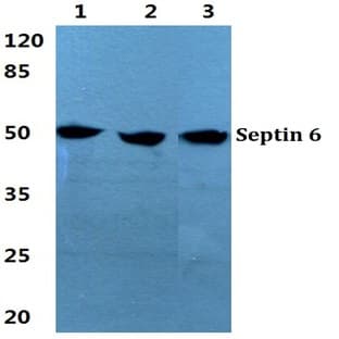 Septin 6 pAb avatar