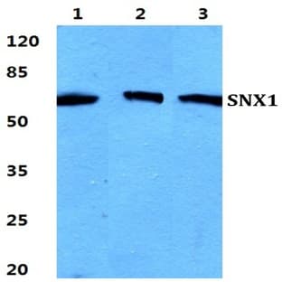 SNX1 pAb avatar