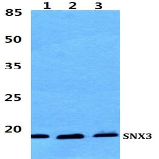 SNX3 pAb avatar