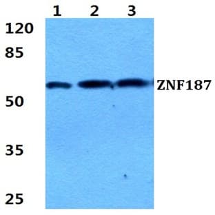 ZNF187 pAb avatar