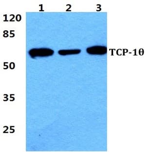 TCP-10 pAb avatar