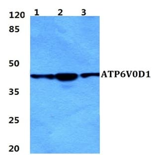 ATP6V0D1 pAb avatar
