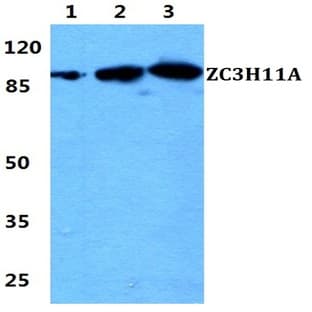 ZC3H11A pAb avatar