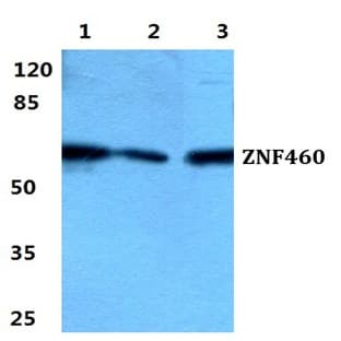 ZNF460 pAb