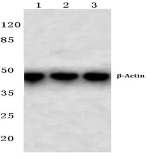 (beta)-Actin (4D3) mAb avatar