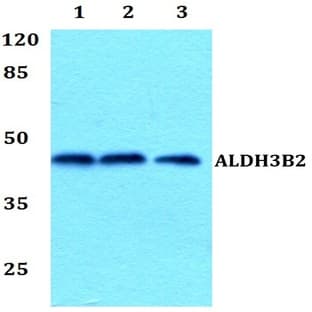 ALDH3B2 pAb avatar