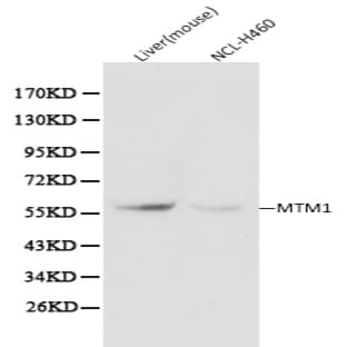 Myotubularin pAb avatar