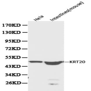 Cytokeratin 20 pAb avatar