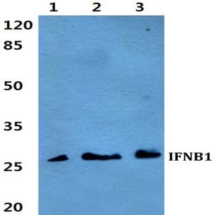 IFNB1 pAb avatar