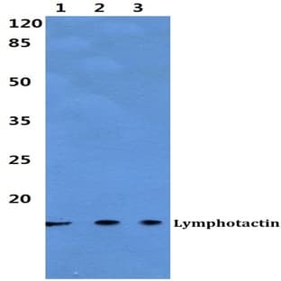Lymphotactin pAb avatar