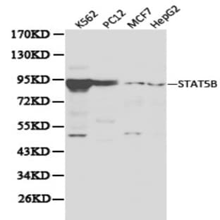 Stat5b pAb