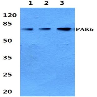 PAK6 pAb avatar