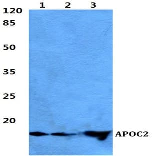 APOC2 pAb avatar