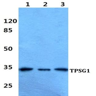 TPSG1 pAb avatar