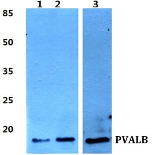 Parvalbumin (alpha) pAb avatar