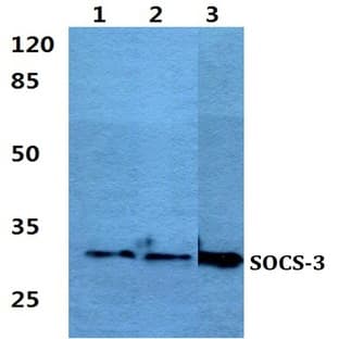 SOCS-3 pAb avatar