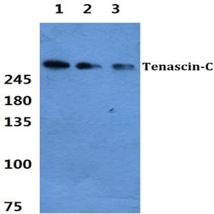 Tenascin-C pAb avatar