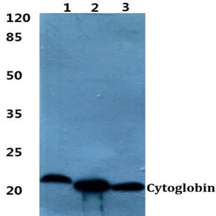 Cytoglobin pAb avatar