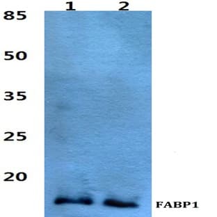 FABP1 pAb avatar