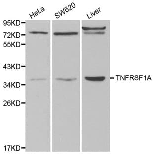 TNFRSF1A pAb avatar