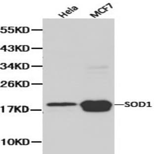 SOD1 pAb avatar