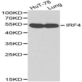 IRF-4 pAb