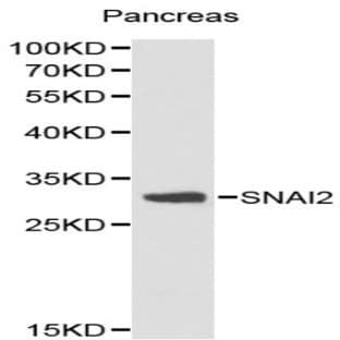 SNAI2 pAb avatar