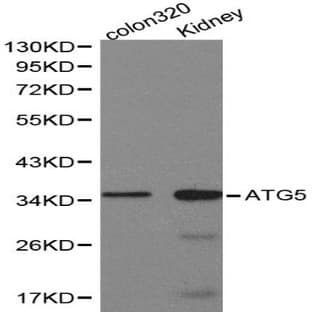 ATG5 pAb avatar