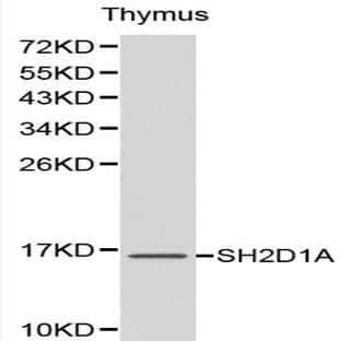 SH2D1A pAb avatar