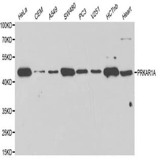 PKA I(alpha) reg pAb avatar